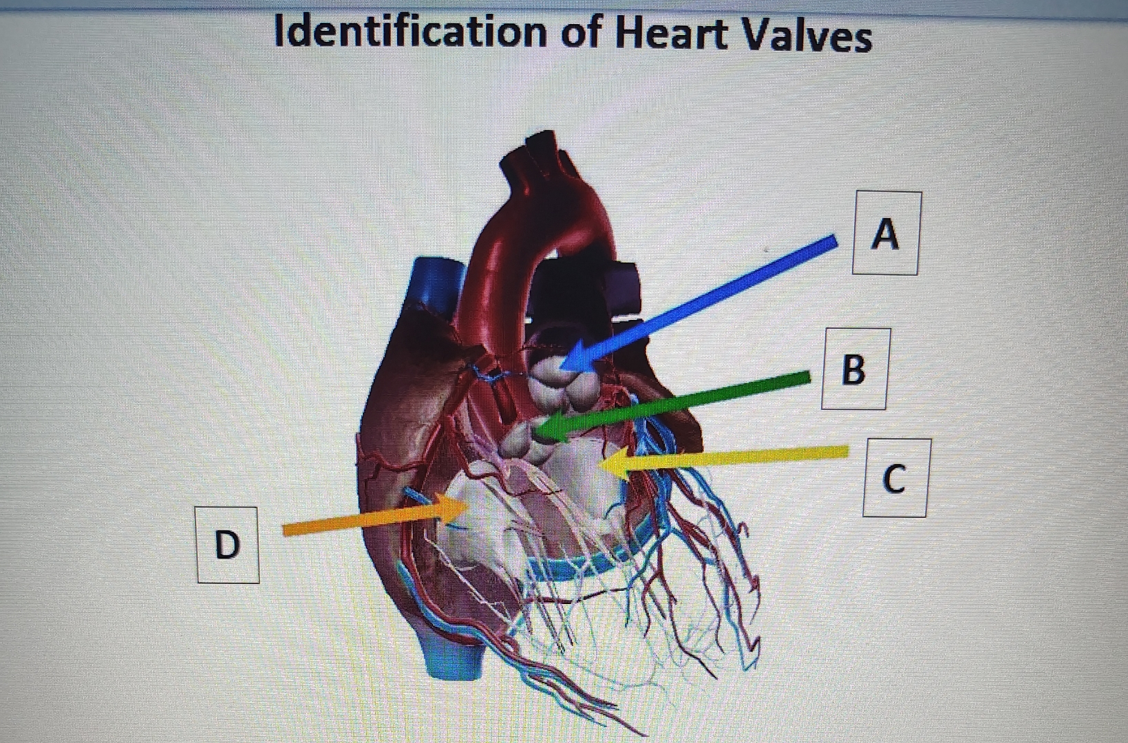 Solved Identification of Heart Valves identify the heart | Chegg.com