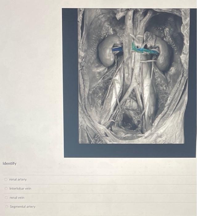 Identify renal artery Interlobar vein renal vein | Chegg.com