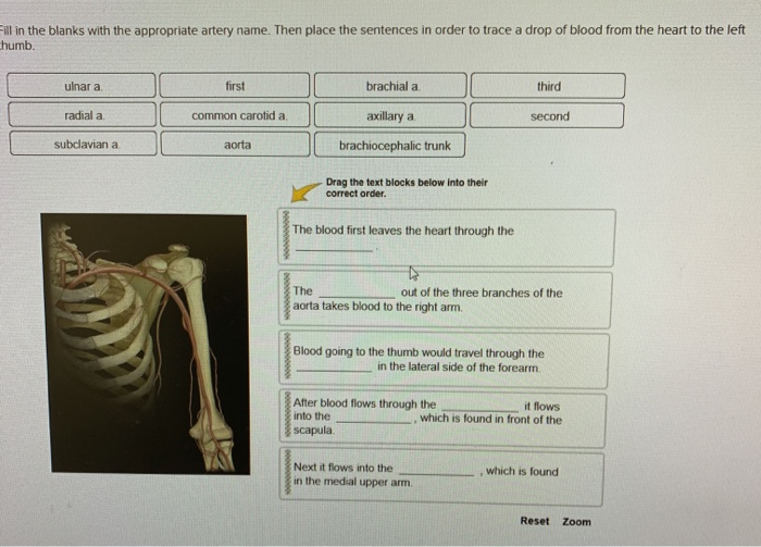 Solved Fill in the blanks with the appropriate artery name.