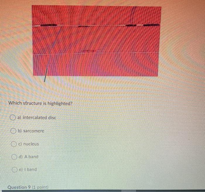 Solved Which structure is highlighted? a) intercalated disc