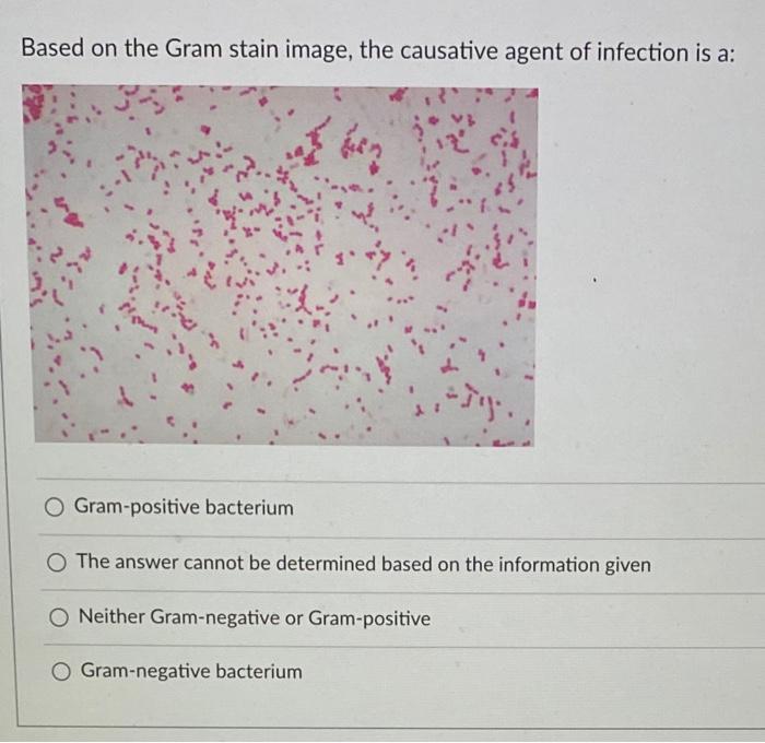 Solved What amino acid sequence would arise from the | Chegg.com