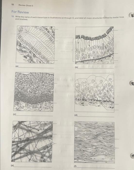 Solved Write the name of each tissue type in illustrations | Chegg.com