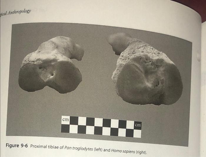 Solved Figure 9-5 Pelvis of Homo erectus (above) and | Chegg.com