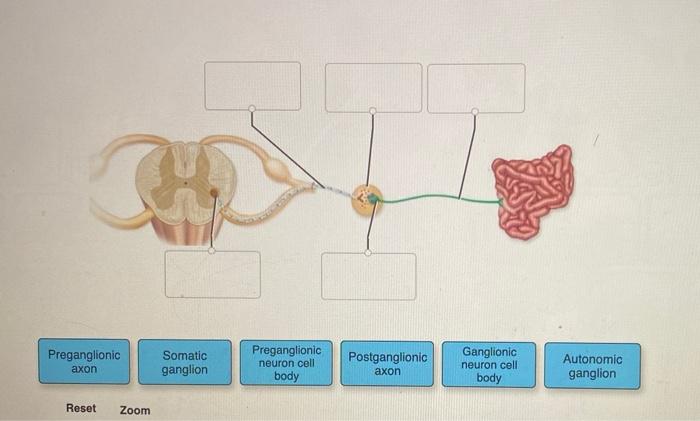 Solved Preganglionic Somatic ganglion Preganglionic neuron | Chegg.com