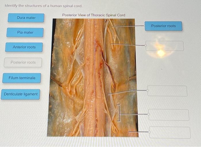 solved-identify-the-structures-of-a-human-spinal-cord-chegg