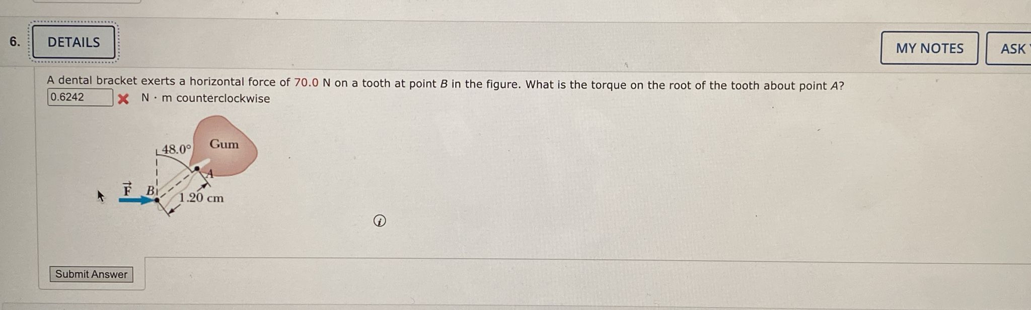 Solved DETAILSA dental bracket exerts a horizontal force of
