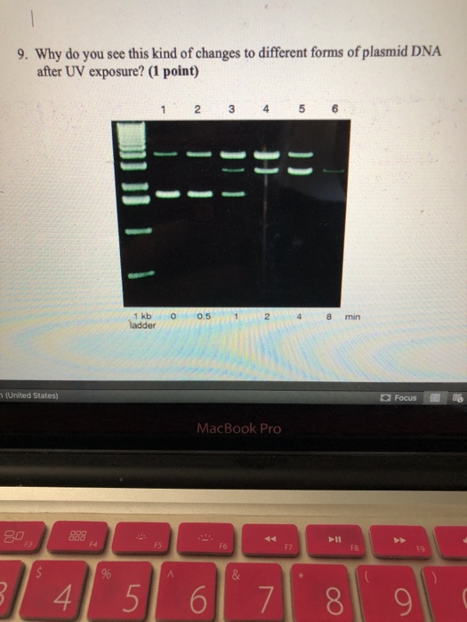 Solved 8. We expose the plasmid DNA to UV for increasing | Chegg.com