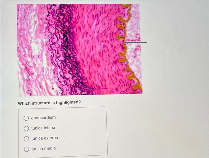 Solved Which structure is highlighted? endocardium O tunica