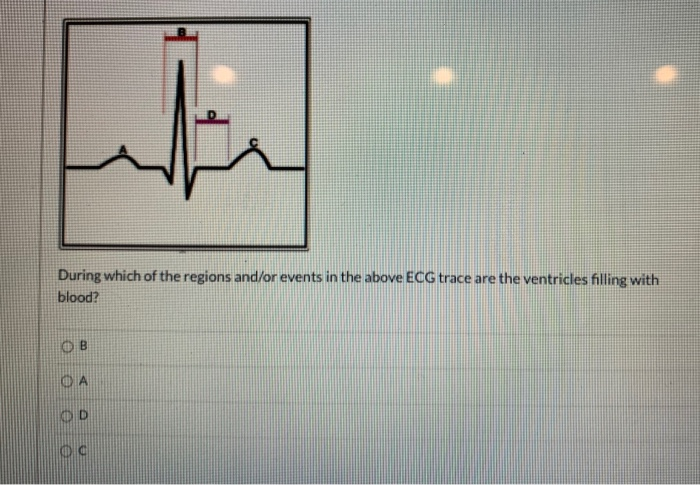 Ecg regions best sale