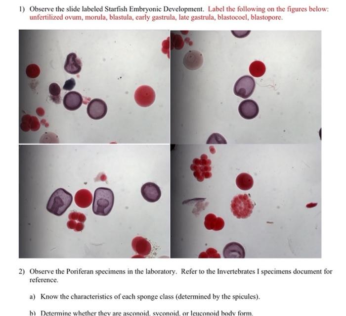 1) Observe the slide labeled Starfish Embryonic Development. Label the following on the figures below: unfertilized ovum, mor