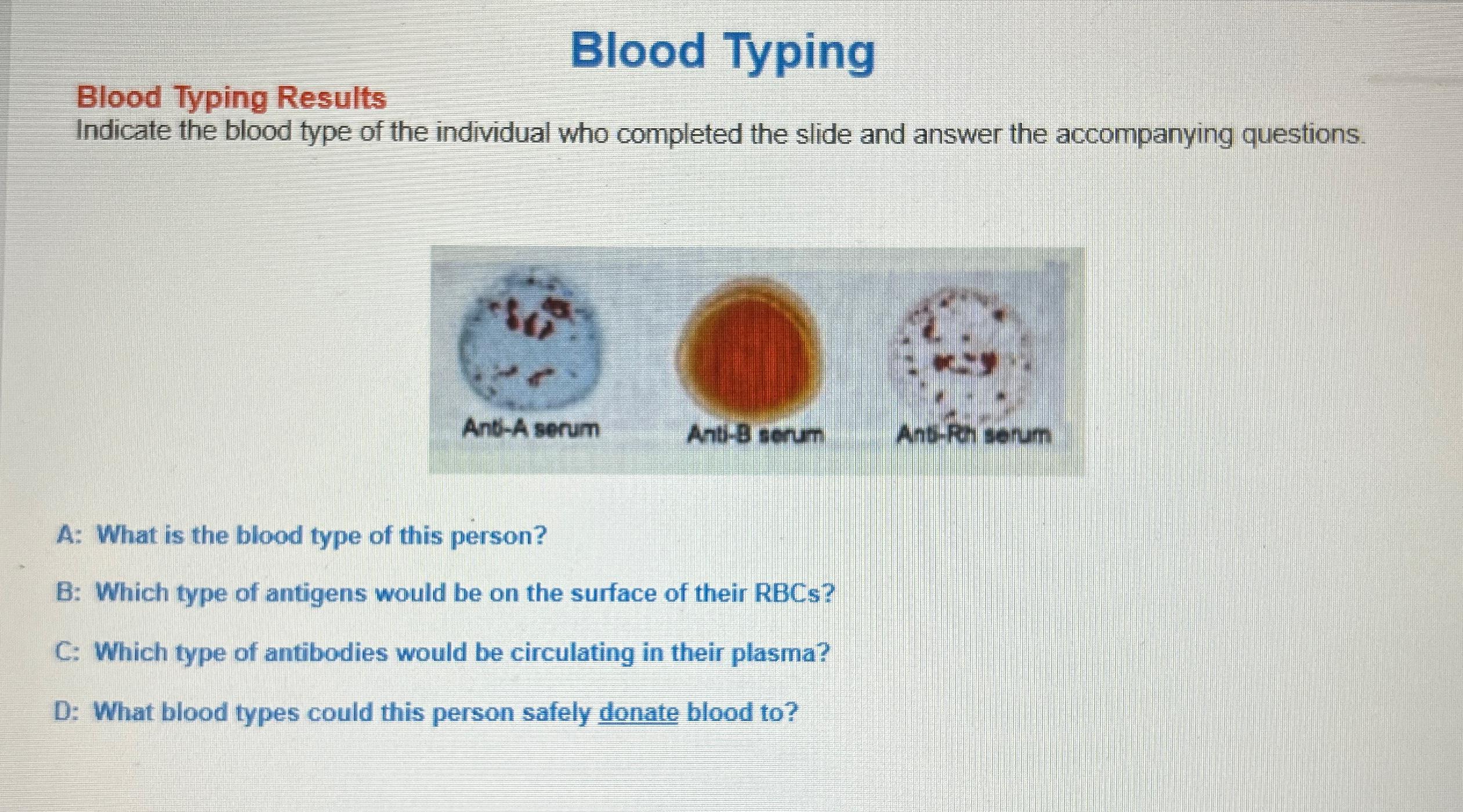 solved-blood-typingblood-typing-resultsindicate-the-blood-chegg