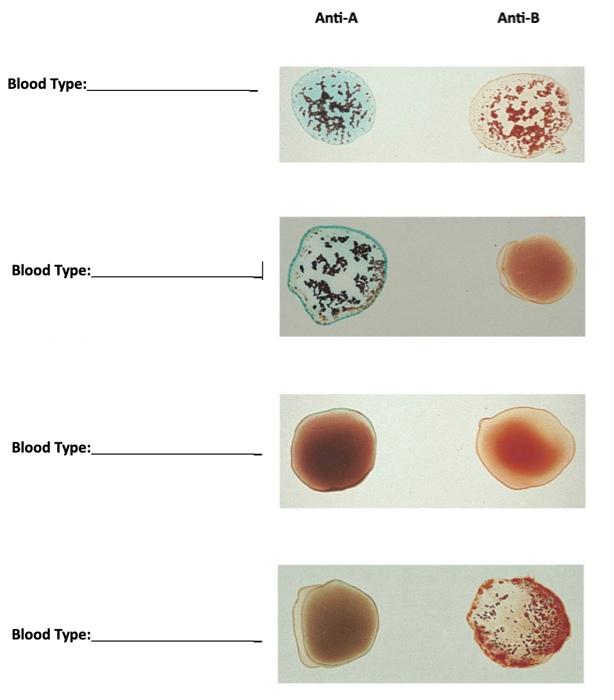 Solved On this blood types document, identify the different | Chegg.com