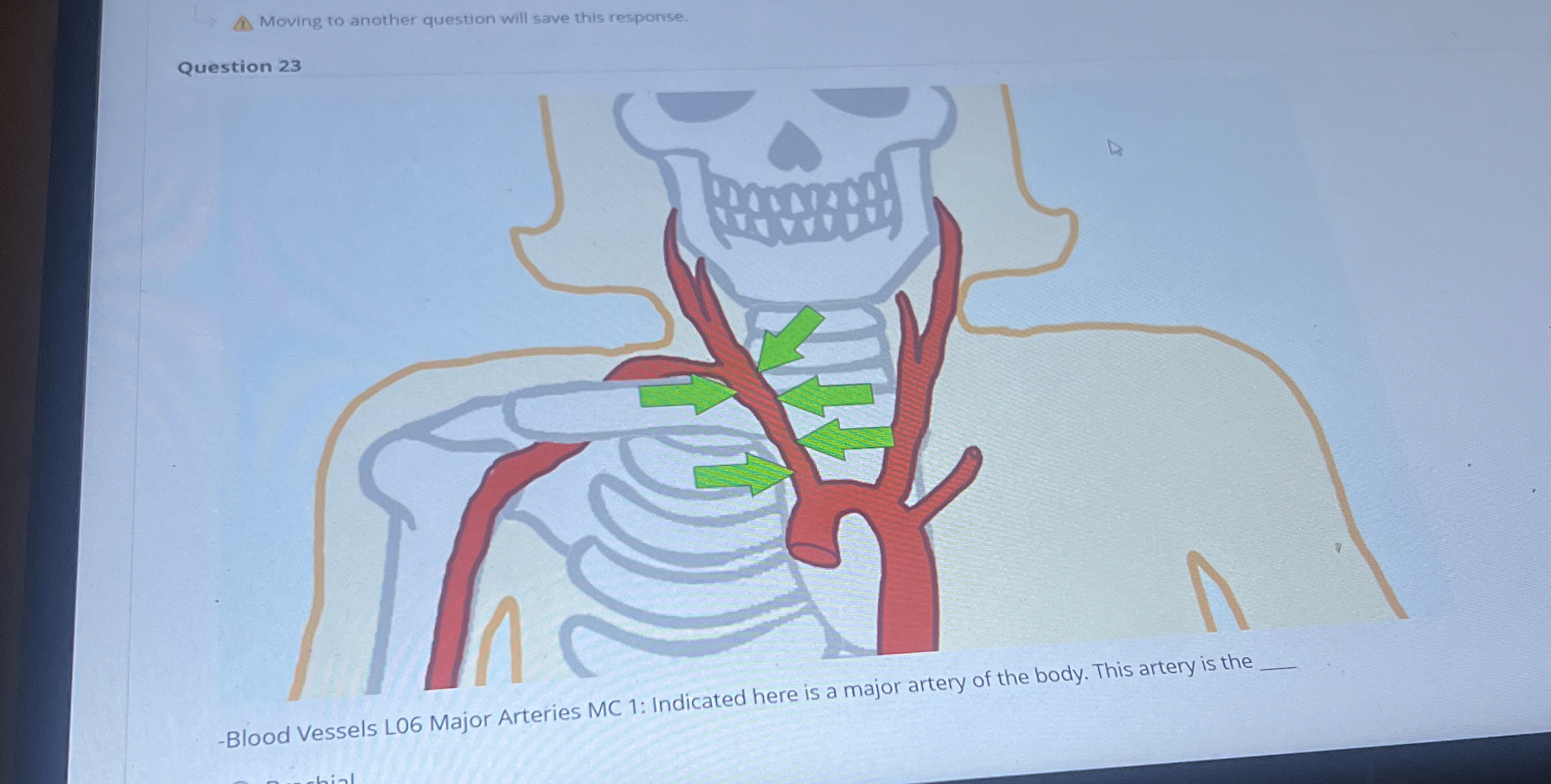 student submitted image, transcription available below