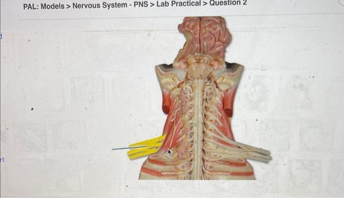 Solved PAL: Models > Nervous System - PNS > Lab Practical > | Chegg.com