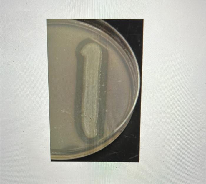 Solved lipid hydrolysis test results show... negative or 50% | Chegg.com