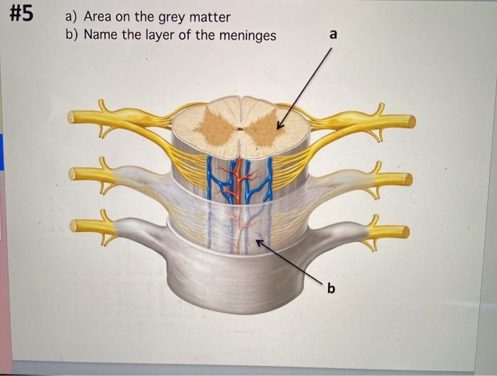 Solved #1 a) Name the elevated ridges b) Name the lobe a b | Chegg.com