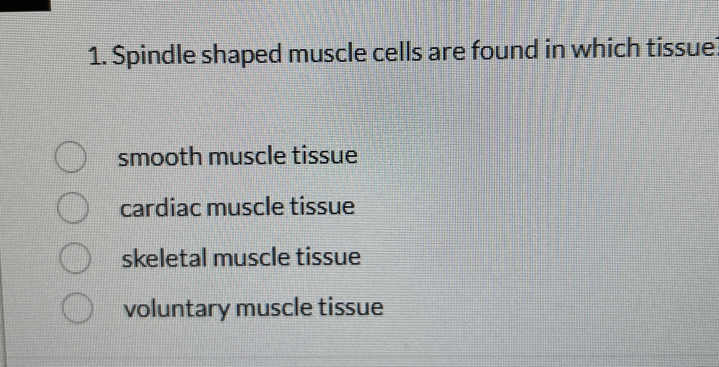 Solved Spindle shaped muscle cells are found in which | Chegg.com