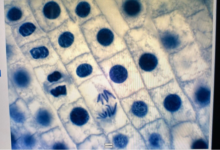 Solved Mitosis EXERCISE 1: OBSERVATION OF MITOSIS IN A PLANT | Chegg.com