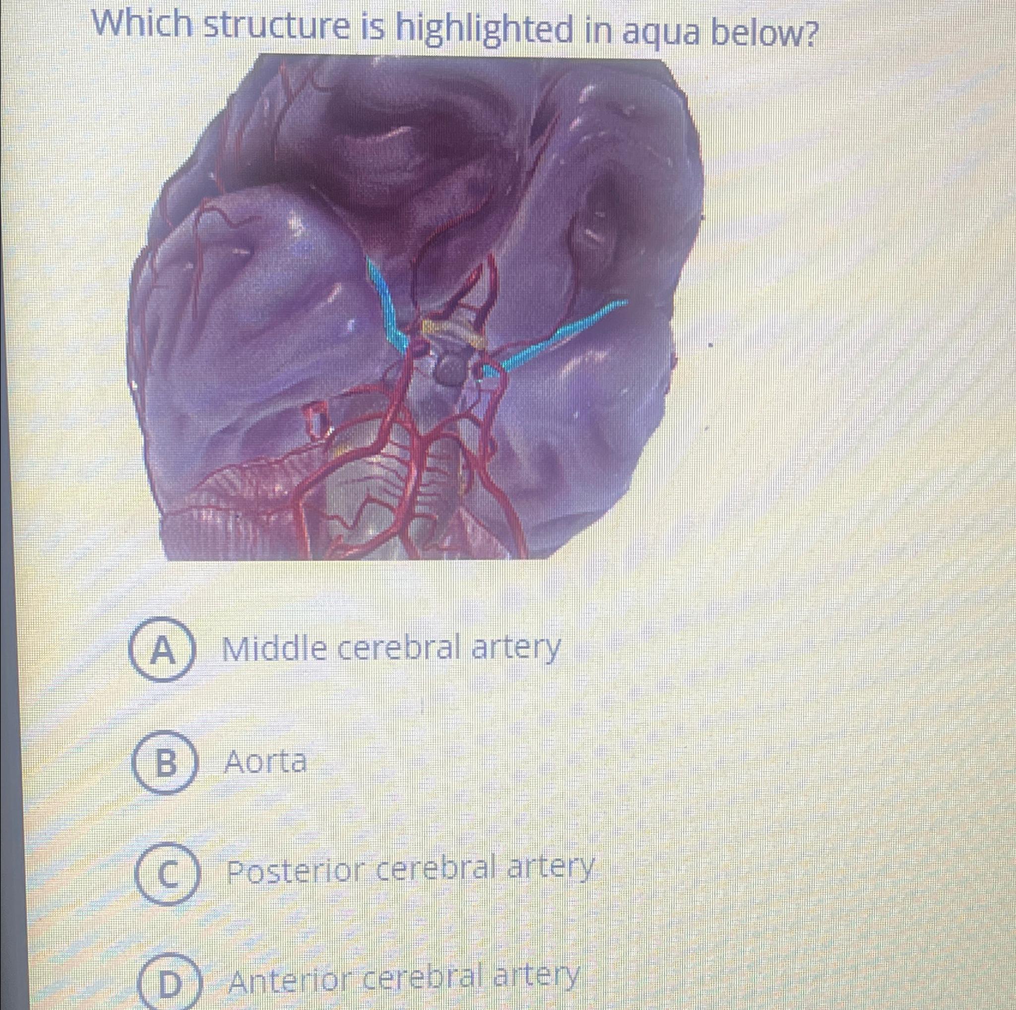 Solved Which structure is highlighted in aqua below?Middle | Chegg.com