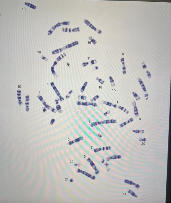 On the next page is a banded chromosome spread from a | Chegg.com