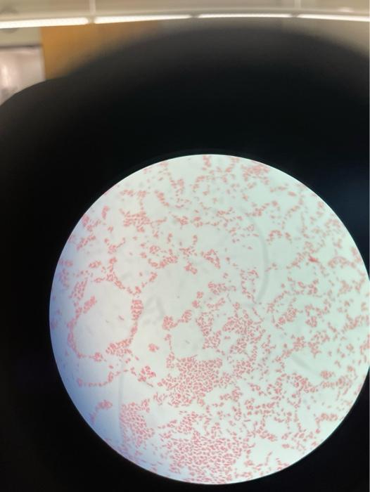 Solved Morphology I Know Its A Gram Stain Negative And It | Chegg.com