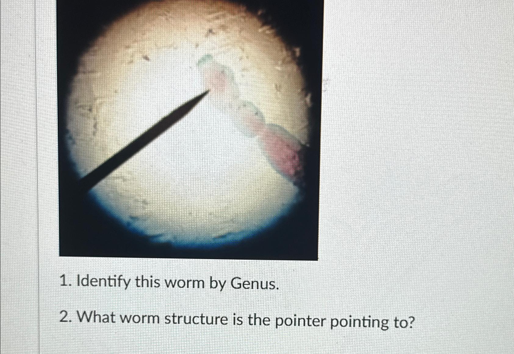 Solved Identify this worm by Genus.What worm structure is | Chegg.com