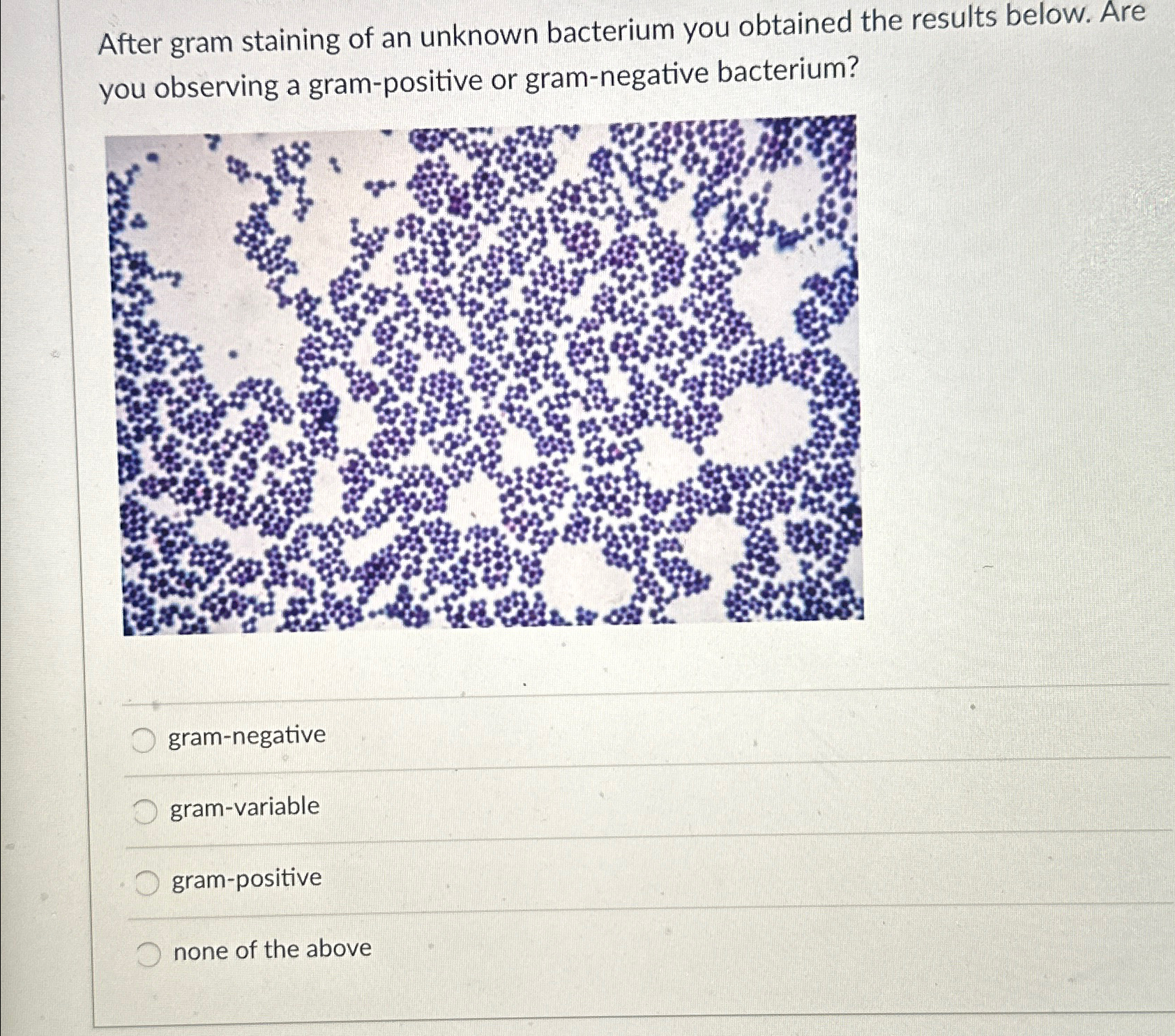 Solved After gram staining of an unknown bacterium you | Chegg.com