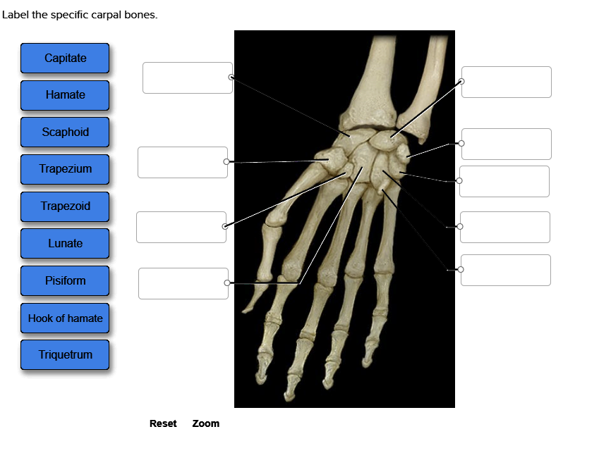 Solved Label the specific carpal bones. | Chegg.com