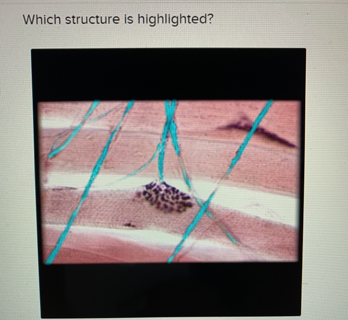 which-structure-is-highlighted-o-skeletal-muscle-chegg