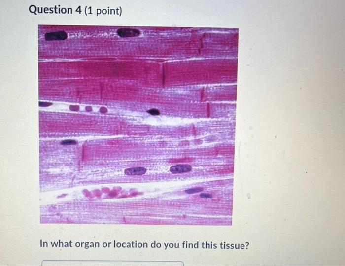 Solved Question 4 1 Point In What Organ Or Location Do