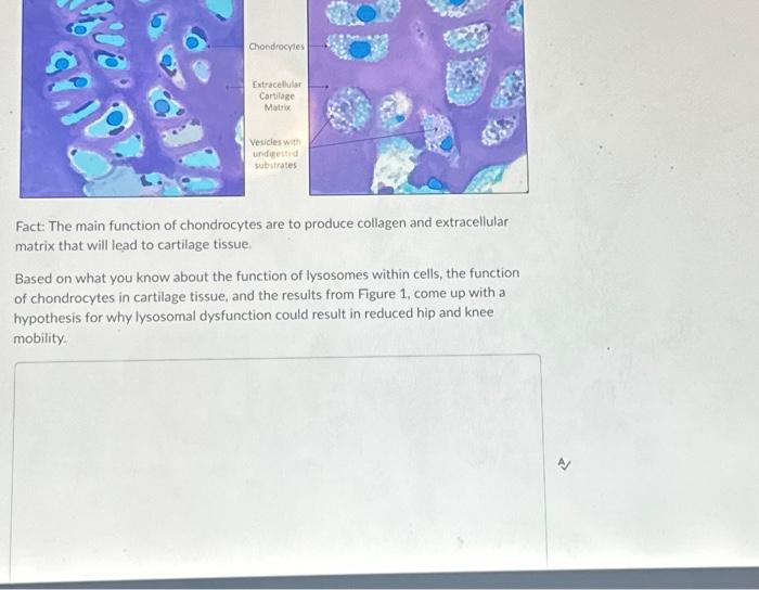 Solved Chondrocytes Extracellular Cartilage Matrix Vesicles | Chegg.com