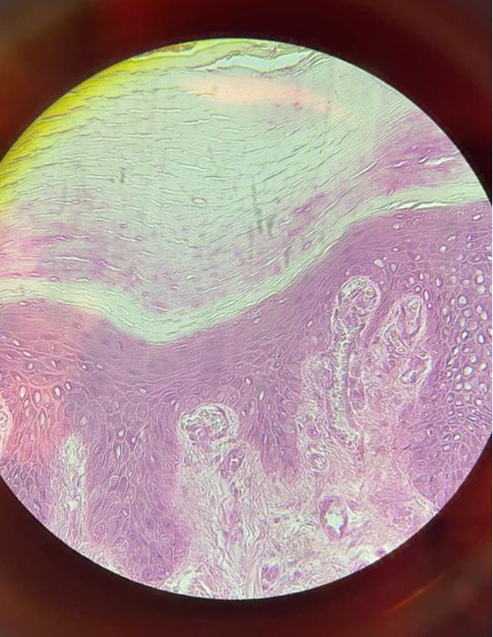 Solved 1. Contrast the thickness of the stratum corneum in | Chegg.com