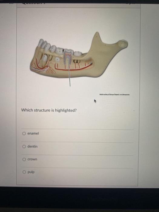 Solved Which structure is highlighted? O enamel dentin Crown | Chegg.com