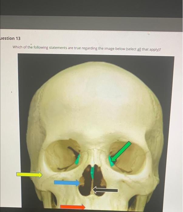 Solved The bone indicated by the blue arrow is the palatine | Chegg.com