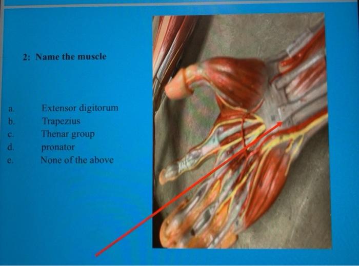 Solved 2: Name the muscle a b. c. d. e. Extensor digitorum | Chegg.com