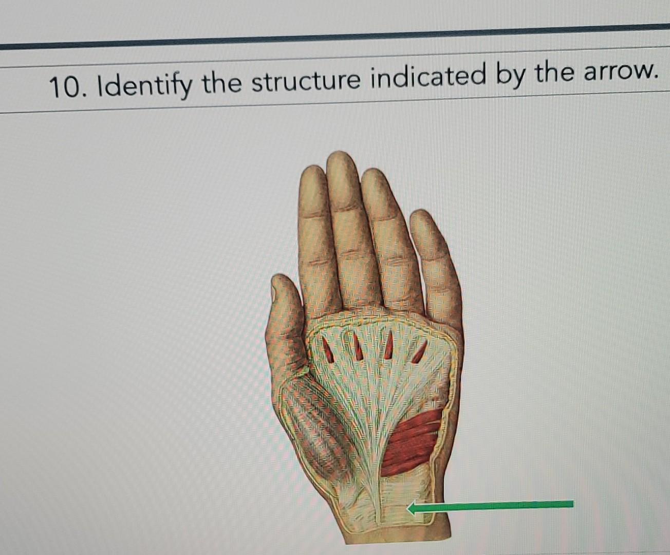 Solved 10. Identify the structure indicated by the arrow. | Chegg.com