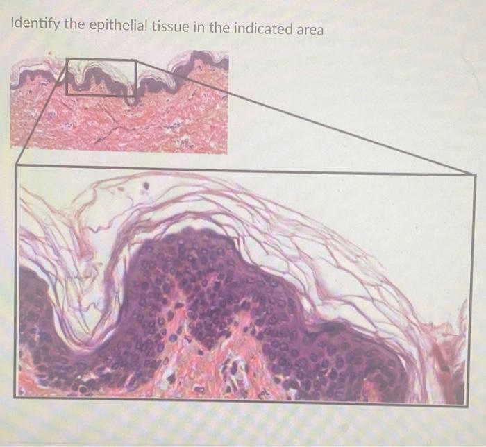 Solved Identify the epithelial tissue in the indicated area | Chegg.com