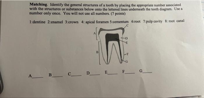 Solved Matching. Identify the general structures of a tooth | Chegg.com