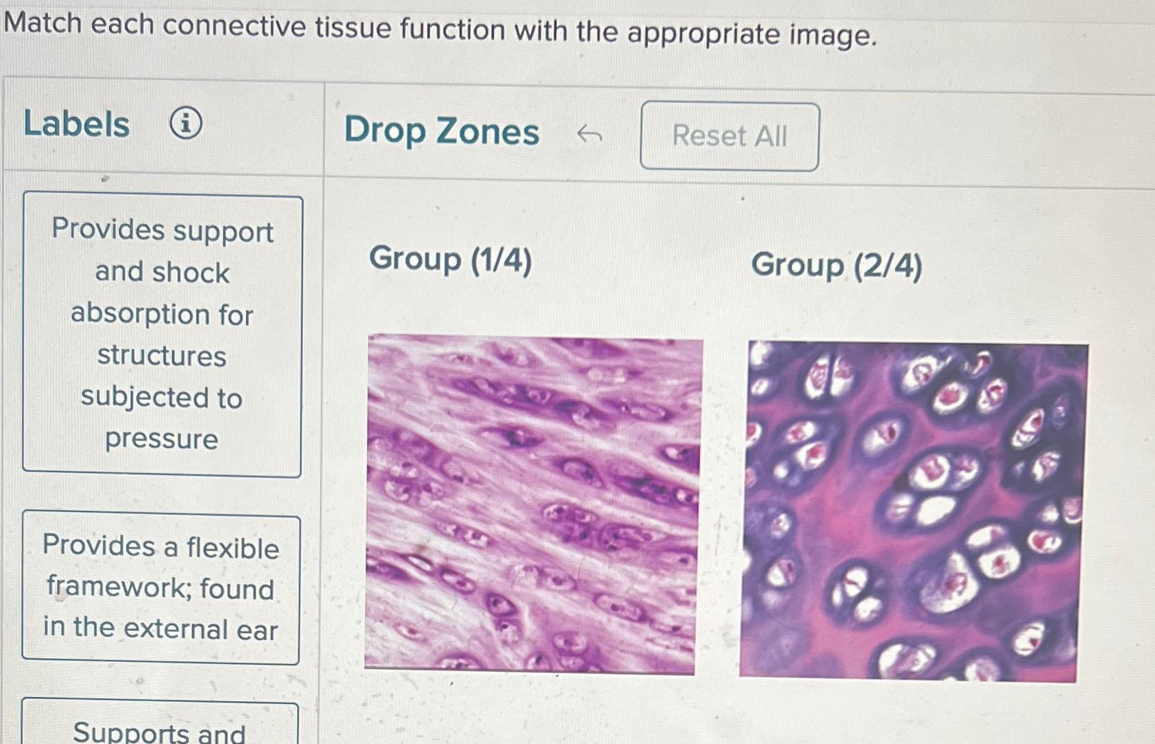 Solved Match each connective tissue function with the