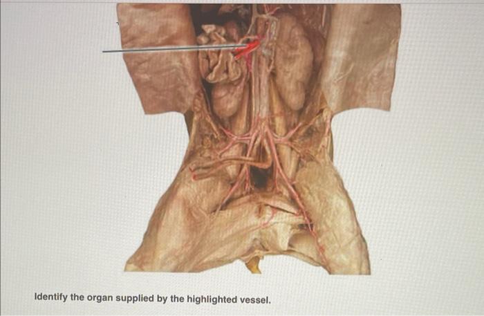 Identify the organ supplied by the highlighted vessel.