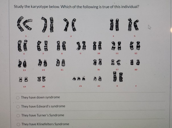 Solved Study the karyotype below. Which of the following is | Chegg.com