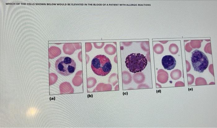 WHICH OF THE CELLS SHOWN BELOW WOULD BE ELEVATED IN THE BLOOD OF A PATIENT WITH ALLERGIC REACTIONS () () (b) (C) (a)
