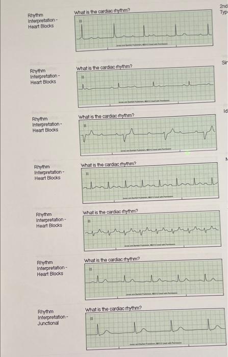 Solved Subject Rhythm Interpretation- Atrial Question | Chegg.com