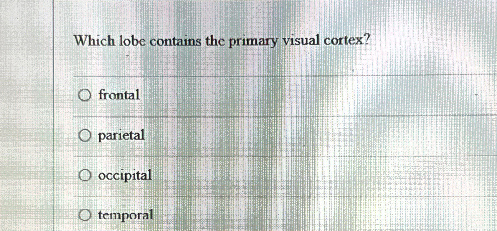 Solved Which lobe contains the primary visual | Chegg.com