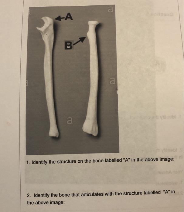 Solved Ro +A A A 1. Identify The Structure On The Bone | Chegg.com