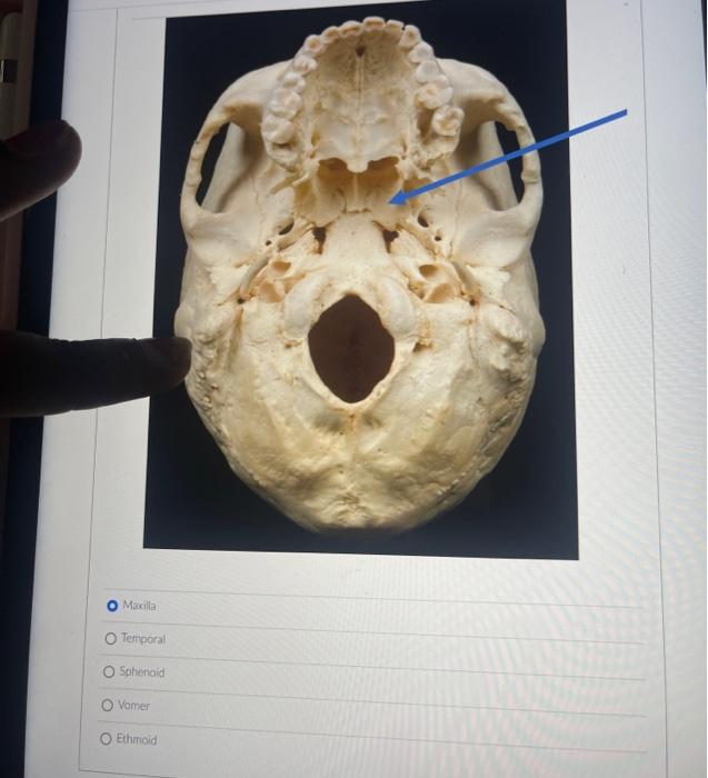 Maxilla
Temporal
sphingid
Vomer:
Ethmoid