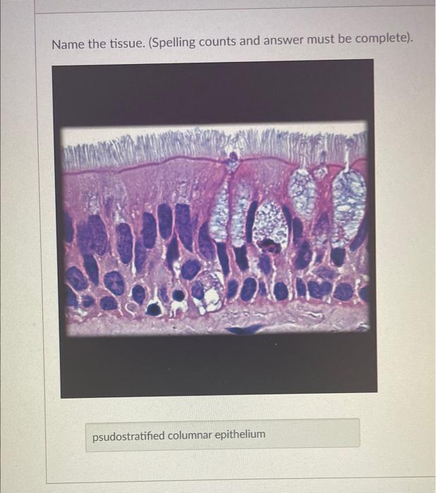 Solved Name the tissue. (Spelling counts and answer must be | Chegg.com