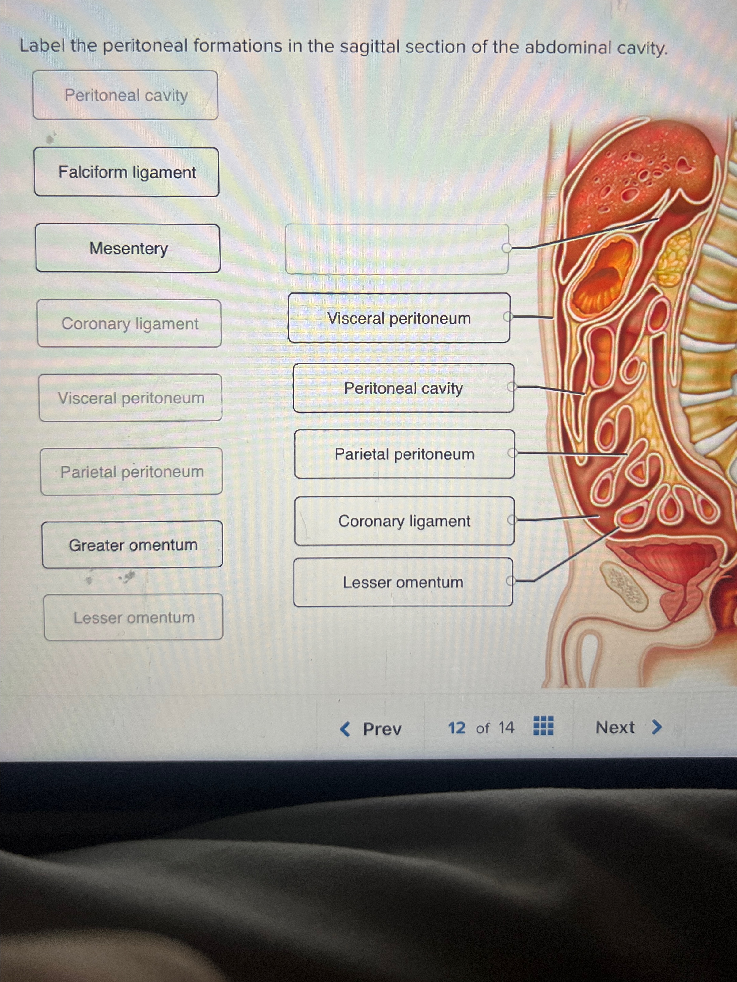 Solved Label the peritoneal formations in the sagittal | Chegg.com