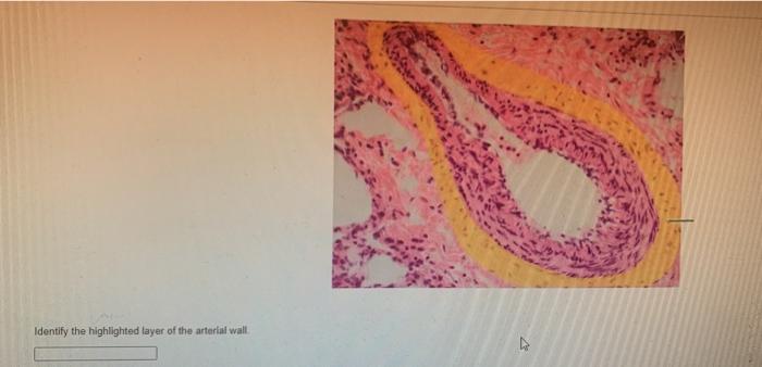 Solved Identify the highlighted layer of the arterial wall | Chegg.com