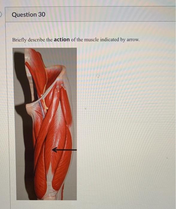 Solved Identify the muscle indicated by arrow. What is the | Chegg.com